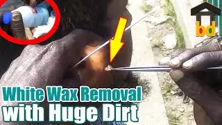 ►Chunky Wax and Dirt Cleaning ASMR BD II Got Refresh with Relaxation & Paid 30 tk for This Service