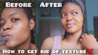 HOW TO GET RID OF TEXTURED SKIN: How I got a smooth skin texture. #texturedskin #skincaretips