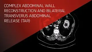 AWR and Bilateral TAR Case Study with the GORE® ENFORM Biomaterial—John P. Fisher, M.D., MPH, FACS