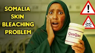 WHAT IS HAPPENING IN SOMALIA?  | THE SKIN BLEACHING PANDEMIC.