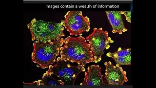 Morgridge Seminar: Imaged-based profiling for drug discovery