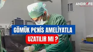 GÖMÜK P€NİS AMELİYATLA  UZATILIR MI ?