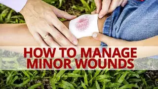 How to Manage and Give First Aid to Minor Wounds