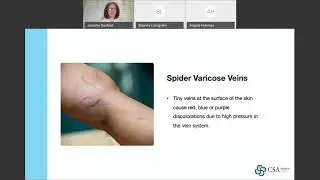 Vein Disease & Treatment Options with Dr. Jennifer Sanford, Vascular Surgeon
