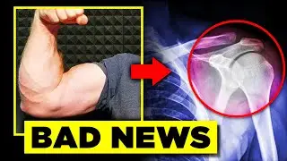 One Of The Worst Armwrestling Injuries Possible