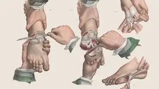 The Horror Picture Of Past Surgery