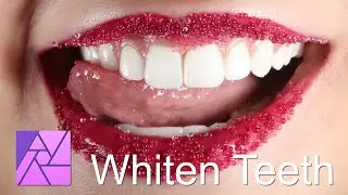 Whiten Teeth with Affinity Photo + Free Macro