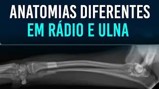 Variações anatômicas em rádio e ulna