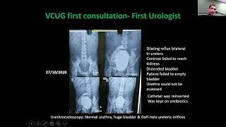 Underactive Bladder Etiology, Diagnosis, treatment by Anil Takvani