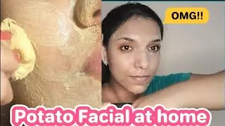 Potato Face pack ഒറ്റ യൂസിൽ മുഖം വെളുക്കും 😱😱😱!!!!!ആദ്യ യൂസിൽ തന്നെ അടിപൊളി Result 💯💯💯💯