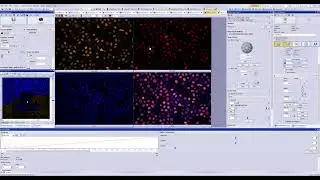 Performance comparison (Olympus) - 8/10 #cellsens #olympus #microscope #fluorescence