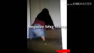 Quad Amputee Born