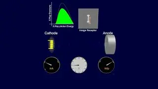 Radiological Sciences Student Project: The exposure time and tube current in a diagnostic X-ray.