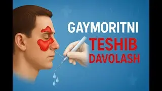 Gaymoritni teshib davolash | пункция | 97-712-10-13 | 