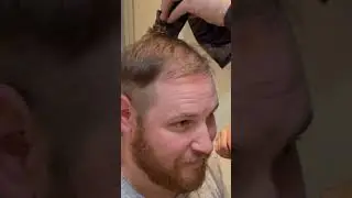 BALDING Man First Time Shaving Head BALD  