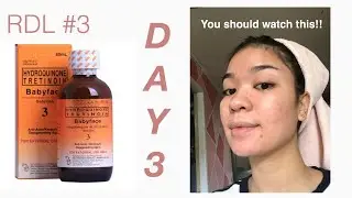 RDL Baby face solution 3 | Day 3