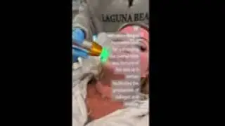 the BEST POST-TREATMENT For Morpheus8 @sqinmed #rfmicroneedling #microneedling