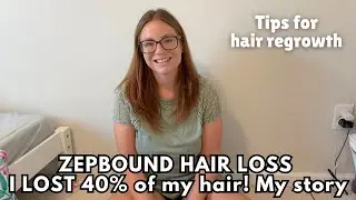 ZEPBOUND HAIR LOSS | I lost A LOT of hair! Regrowth tips