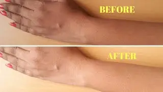 How To Remove Sun Tan From Your Body Instantly | Home remedy