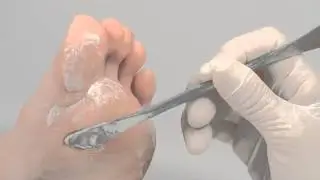 Cómo quitar la piel seca de los talones