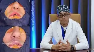 QUYON LAB nuqsoni nima uni qanday bartaraf qilish mumkin?