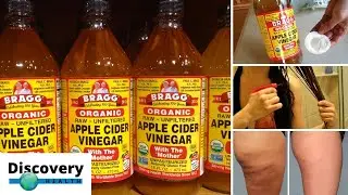 7 Surprising Beauty Benefits of Apple Cider Vinegar | Discovery Health