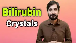 Bilirubin Crystals in Urine Microscopy