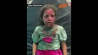 ИЗРАИЛЬСКИЕ БОМБАРДИРОВКИ ОТНЯЛИ ЗРЕНИЕ У ПАЛЕСТИНСКОЙ ДЕВОЧКИ