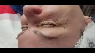 Токсин после.