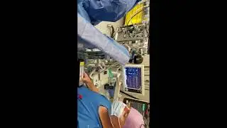 The last op..I hope