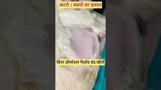 Retention of urine l dr umar khan