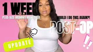 MY FIRST WEEK POST-OP PLUS-SIZE TUMMY TUCK + FOOTAGE || MOMMY MAKEOVER