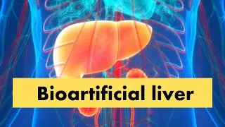 Bioartificial Liver | Artificial Liver | Liver
