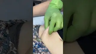MICRODERMAL HIP like a Surface! #piercing #bodypiercing  #microdermal #piercingstudio