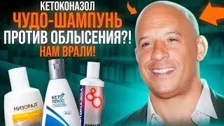 ЕДИНСТВЕННЫЙ ШАМПУНЬ ПРОТИВ ОБЛЫСЕНИЯ. Кетоконазол, вся правда про его чудо-свойства