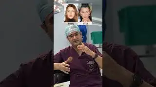 Elevate Your Beauty: Transformative Face Makeover Insights by Dr. Nitesh Lamoria