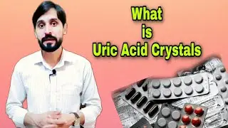 Uric Acid Crystals in Urine | What is Uric Acid Crystals | Uric Acid Stones | Causes | Treatment