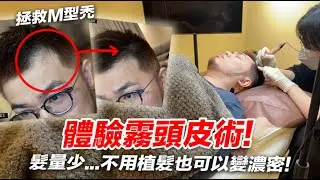 體驗霧頭皮術！髮量少M型禿也可以變濃密？【狸貓】