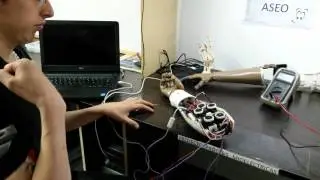 PROTESIS MIOELECTRICA