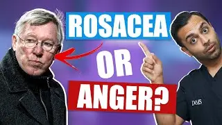What is Rosacea? | 3 Types of Rosacea | Best Treatments For Rosacea by Dr. Somji & Dr. Solomon