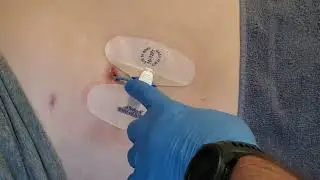 Shower with your biliary drain