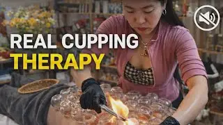 ASMR 🌿 Real Cupping Therapy | Relaxing Natural Sounds | No Talking