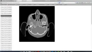 dicom web view