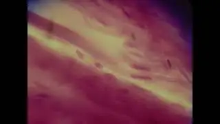 microscopic images of cardiac muscle
