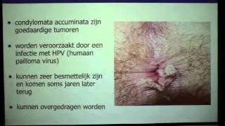Anale condylomen - proctologie - Dr. Tom Feryn