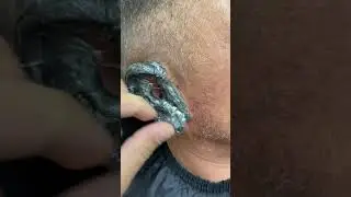Удаление Волос с ушах￼ восками 😊