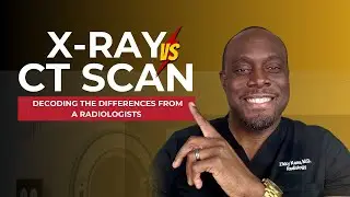 X-ray vs CT Scan: Understanding the Key Differences