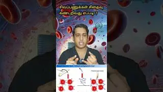 சிவப்பணுக்கள் சிதைவு கண்டறிவது எப்படி|Hemolytic anaemia blood tests|Direct Coomb's test #hemolysis