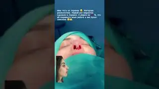 повторная ринопластика
