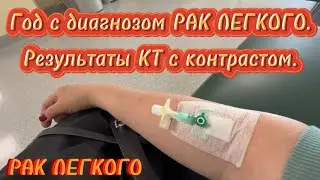 #69 РАК ЛЕГКОГО. Год и два месяца в диагнозе. Результаты контрольного КТ с контрастом.